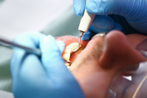 Best Emergency Dentist for Special Needs Patients in Strawberry, CA