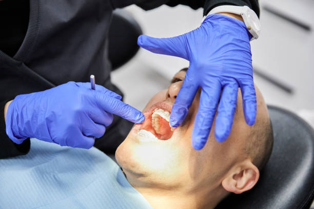 Best Emergency Dentist for Special Needs Patients in Strawberry, CA
